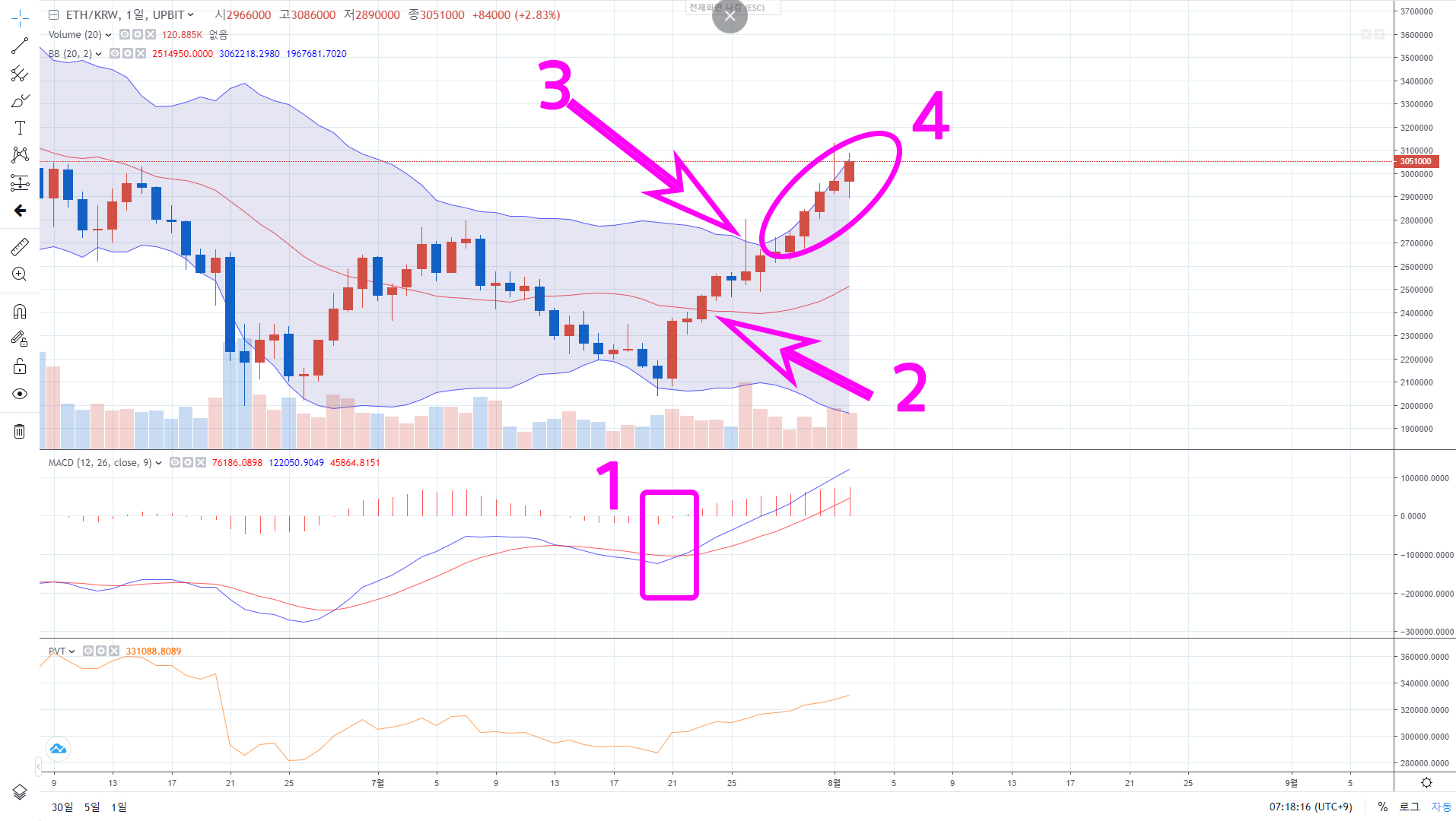 볼린저밴드 보는법 [MACD 지표와 함께] - 자유게시판 - 코인픽